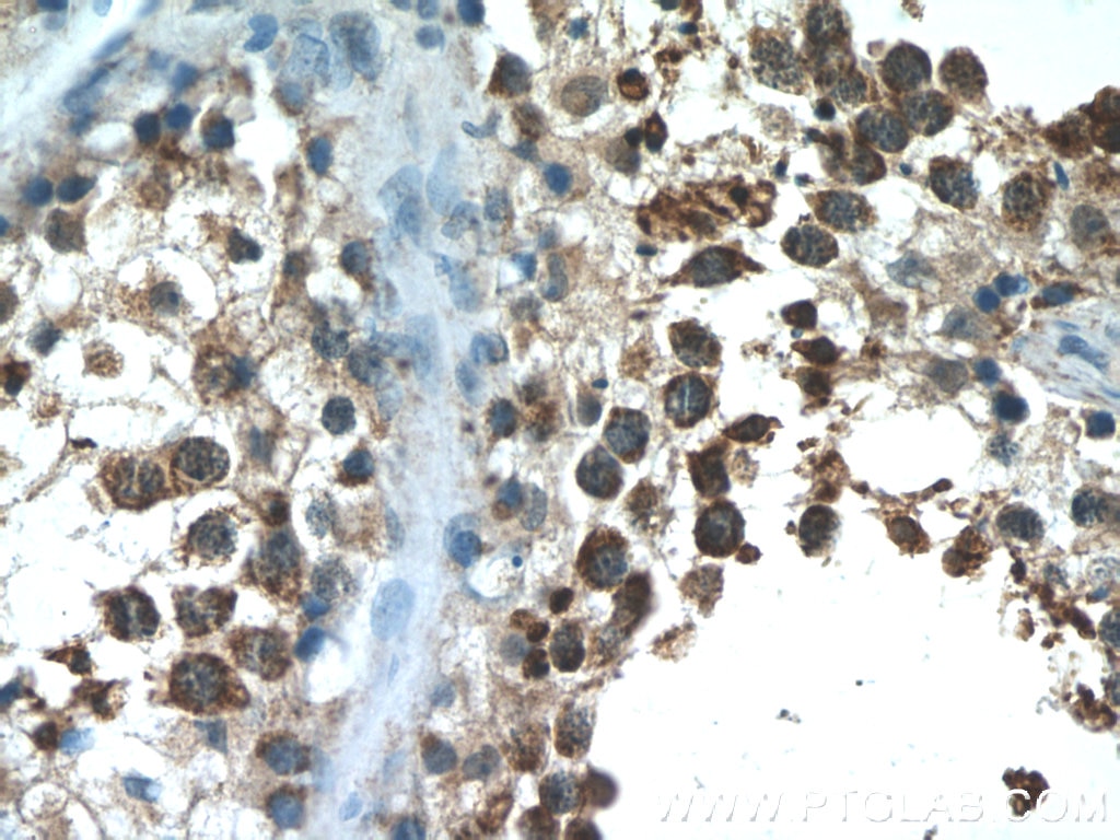 Immunohistochemistry (IHC) staining of human testis tissue using NPFFR2 Polyclonal antibody (19505-1-AP)