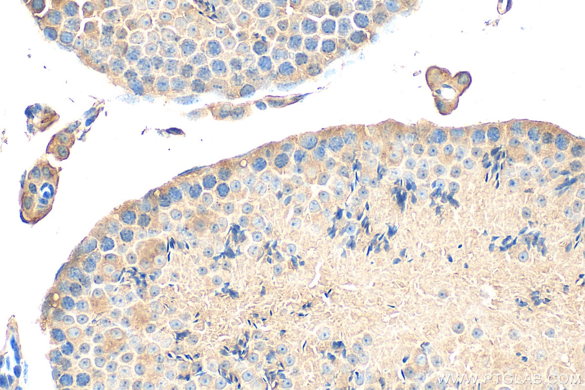 Immunohistochemistry (IHC) staining of mouse testis tissue using NPFFR2 Polyclonal antibody (19505-1-AP)