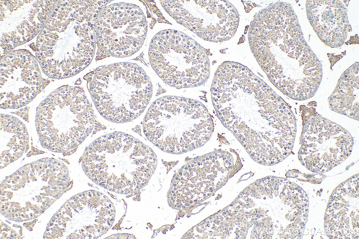 IHC staining of mouse testis using 25971-1-AP