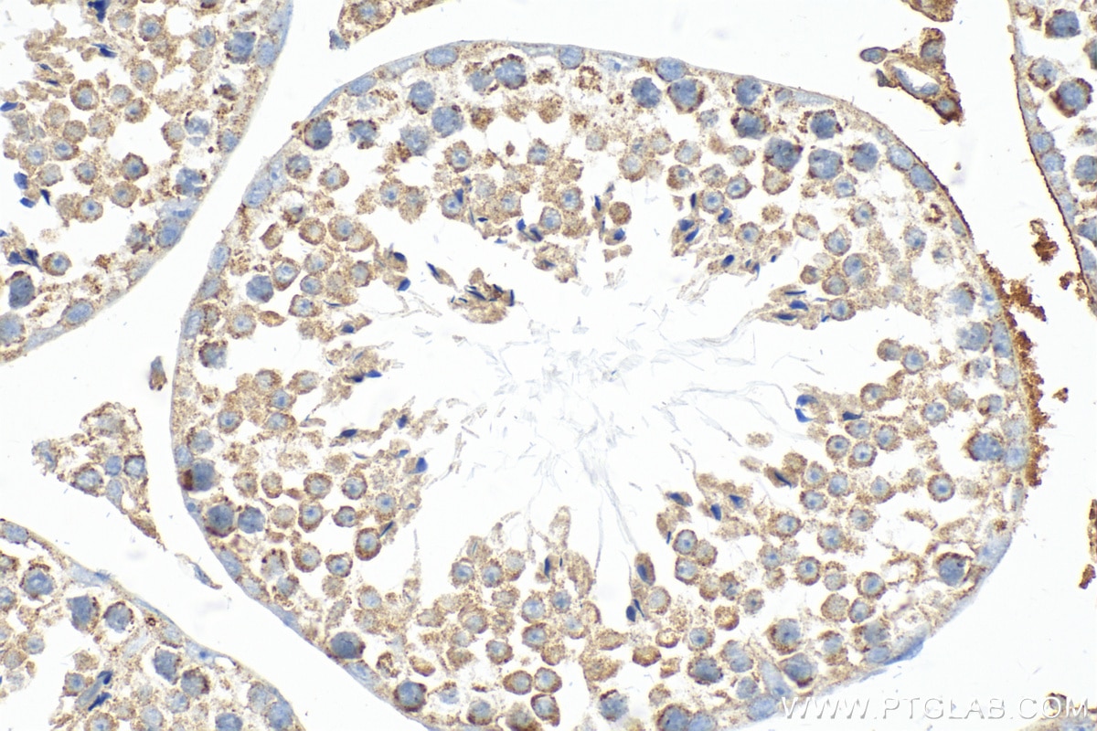 Immunohistochemistry (IHC) staining of mouse testis tissue using NPHP1 Polyclonal antibody (25971-1-AP)