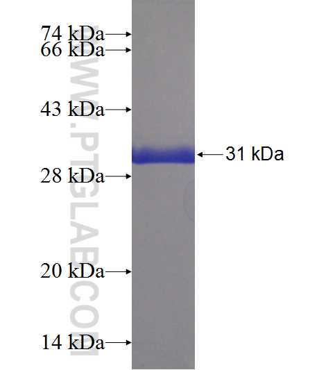 NPHP1 fusion protein Ag22965 SDS-PAGE