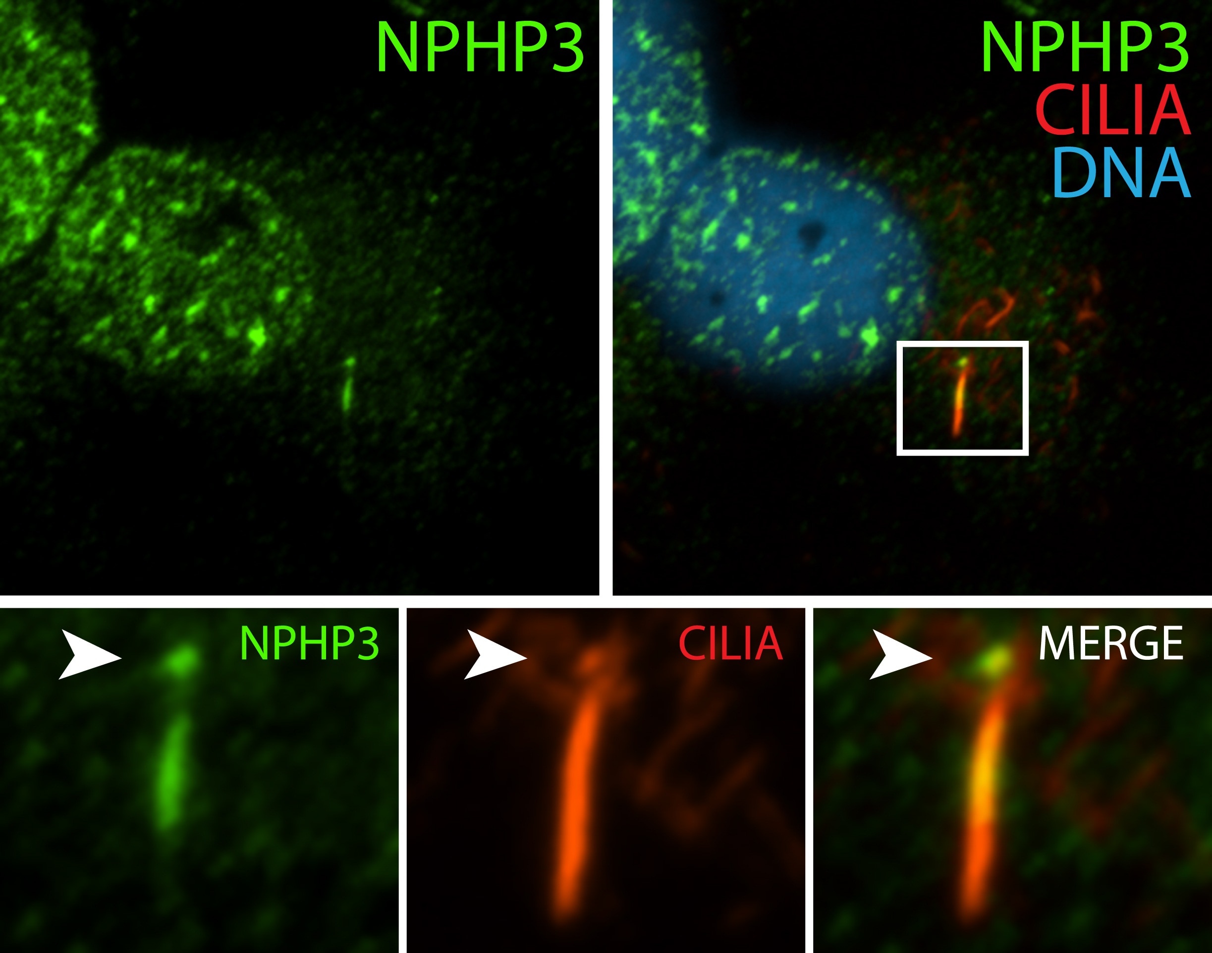Immunofluorescence (IF) / fluorescent staining of hTERT-RPE1 cells using NPHP3 Polyclonal antibody (22026-1-AP)