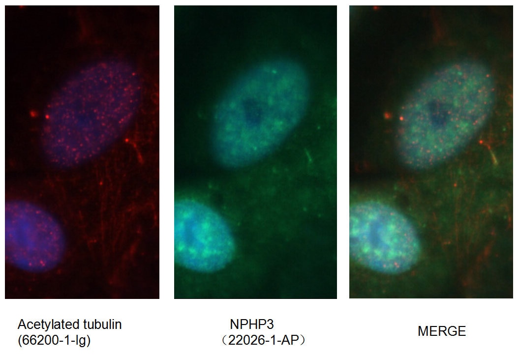 Immunofluorescence (IF) / fluorescent staining of MDCK cells using NPHP3 Polyclonal antibody (22026-1-AP)