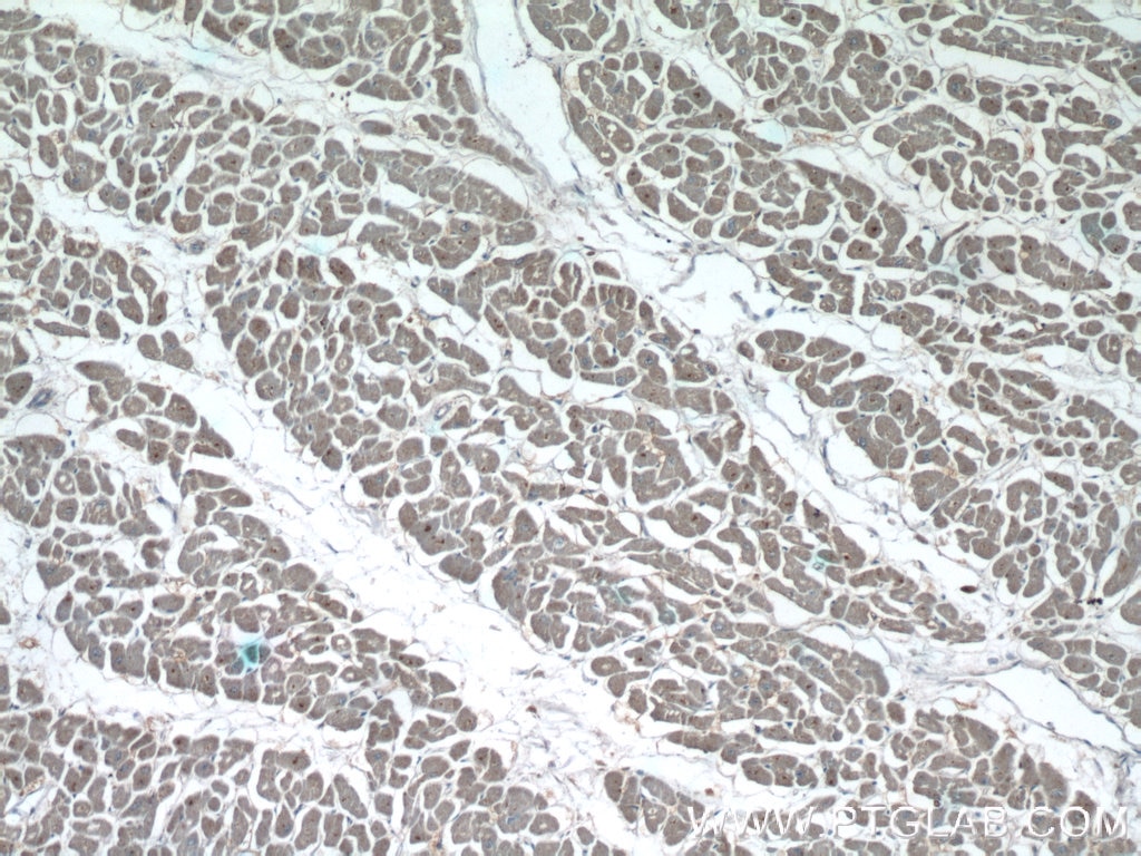 Immunohistochemistry (IHC) staining of human heart tissue using NPHP3 Polyclonal antibody (22026-1-AP)