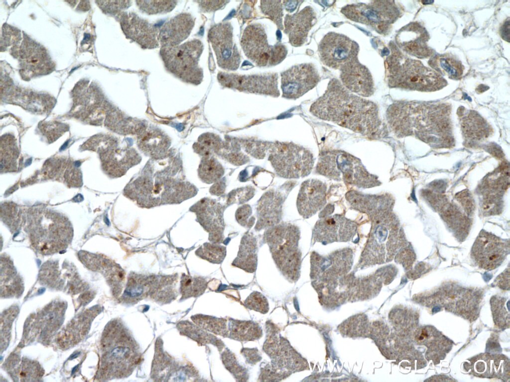 Immunohistochemistry (IHC) staining of human heart tissue using NPHP3 Polyclonal antibody (22026-1-AP)