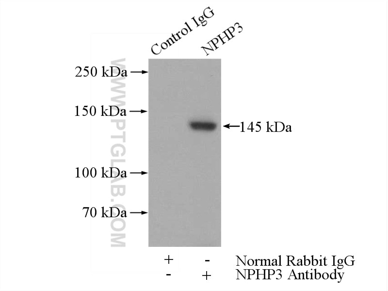 Immunoprecipitation (IP) experiment of mouse testis tissue using NPHP3 Polyclonal antibody (22026-1-AP)