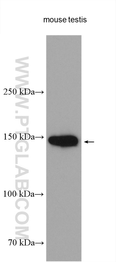 Western Blot (WB) analysis of various lysates using NPHP3 Polyclonal antibody (22026-1-AP)