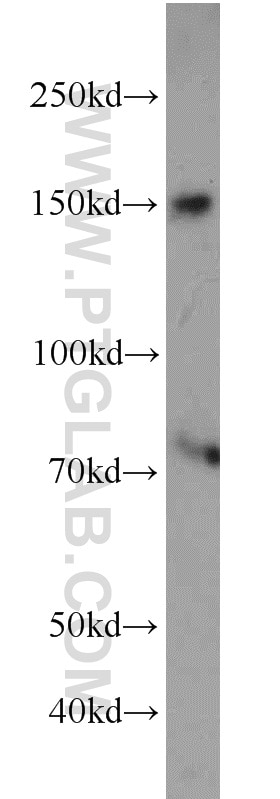 Western Blot (WB) analysis of mouse liver tissue using NPHP3 Polyclonal antibody (22026-1-AP)