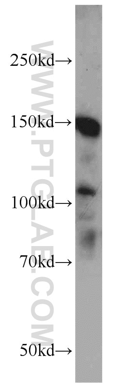 Western Blot (WB) analysis of HEK-293 cells using NPHP3 Polyclonal antibody (22026-1-AP)