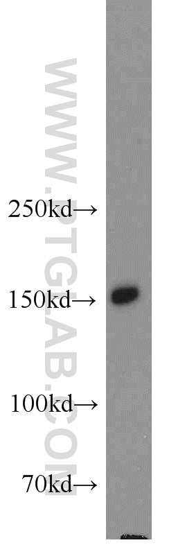 Western Blot (WB) analysis of human testis tissue using NPHP3 Polyclonal antibody (22026-1-AP)