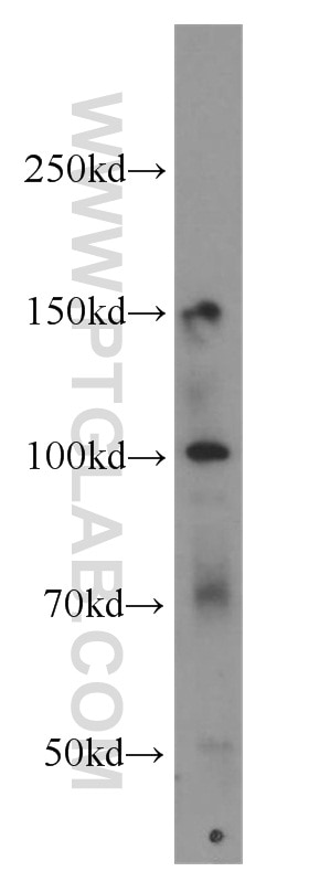 Western Blot (WB) analysis of HepG2 cells using NPHP3 Polyclonal antibody (22026-1-AP)