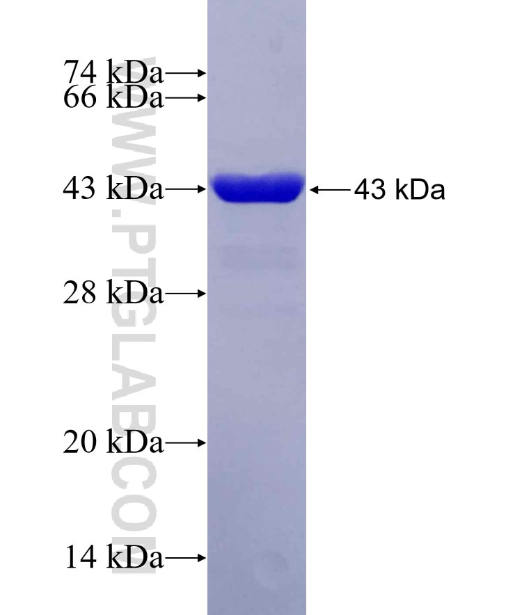 NPHP3 fusion protein Ag16888 SDS-PAGE