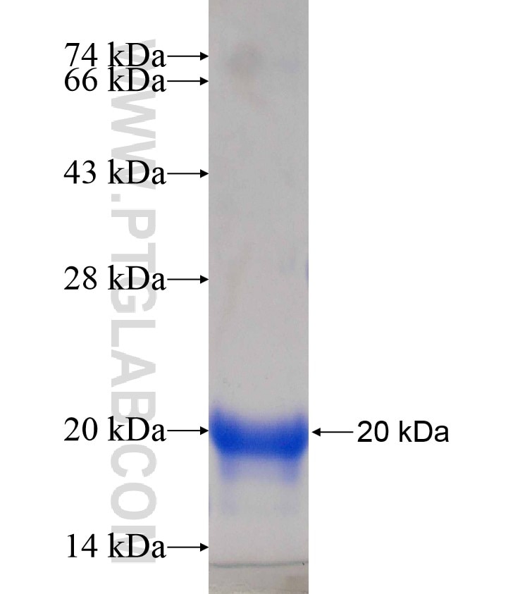 NPHP3 fusion protein Ag17458 SDS-PAGE