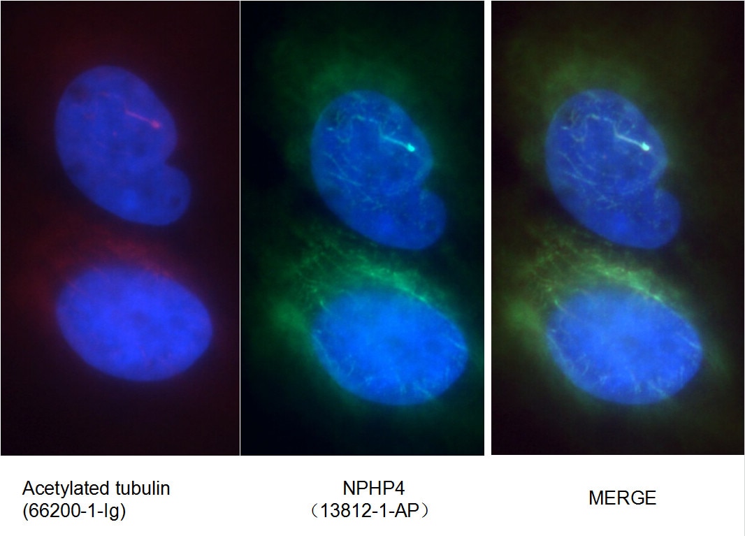 Immunofluorescence (IF) / fluorescent staining of MDCK cells using NPHP4 Polyclonal antibody (13812-1-AP)