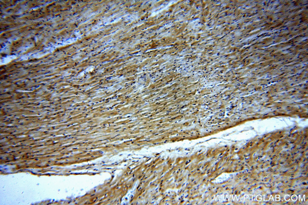 Immunohistochemistry (IHC) staining of human heart tissue using NPHP4 Polyclonal antibody (13812-1-AP)