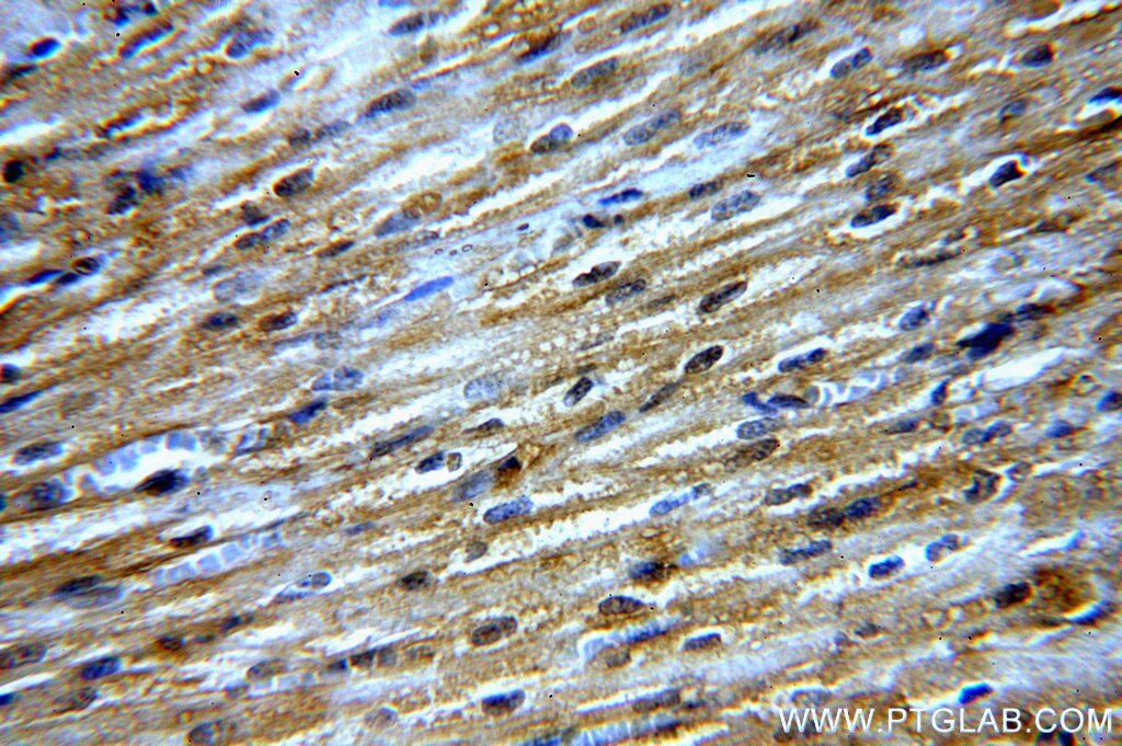 Immunohistochemistry (IHC) staining of human heart tissue using NPHP4 Polyclonal antibody (13812-1-AP)