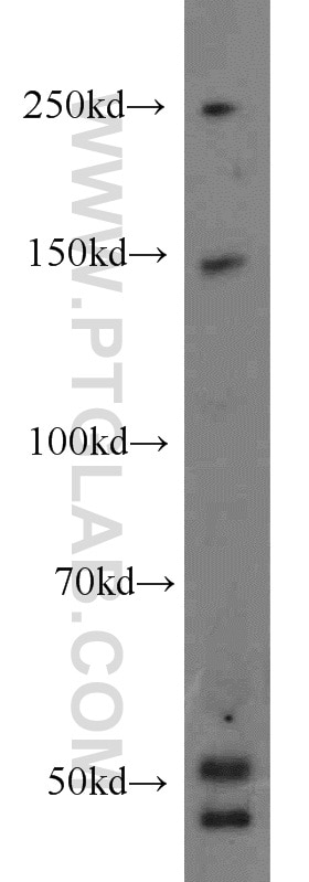 Western Blot (WB) analysis of Y79 cells using NPHP4 Polyclonal antibody (13812-1-AP)