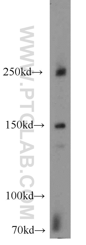 Western Blot (WB) analysis of mouse brain tissue using NPHP4 Polyclonal antibody (13812-1-AP)