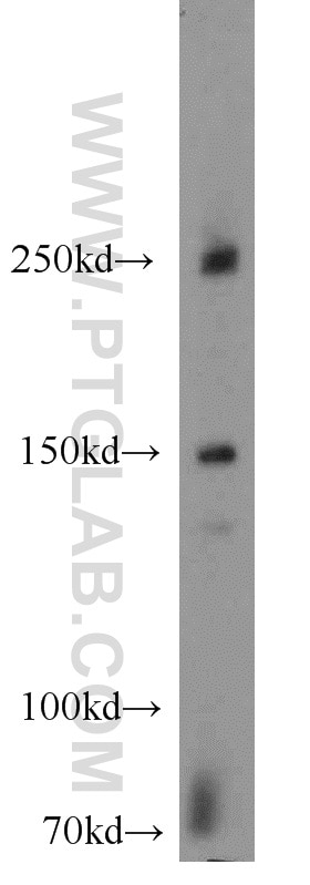 WB analysis of mouse brain using 13812-1-AP