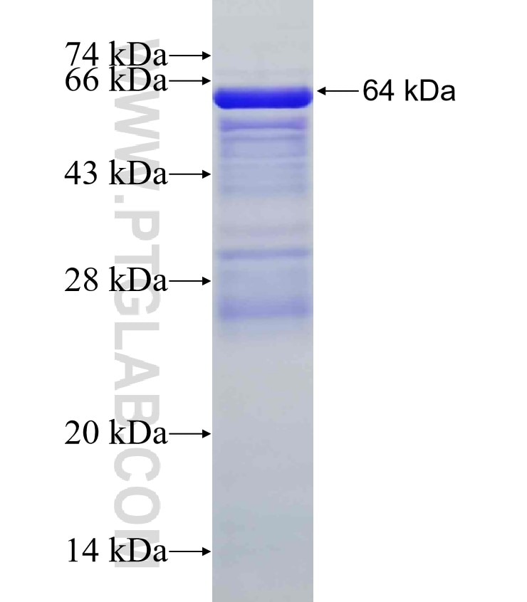 NPHP4 fusion protein Ag4875 SDS-PAGE