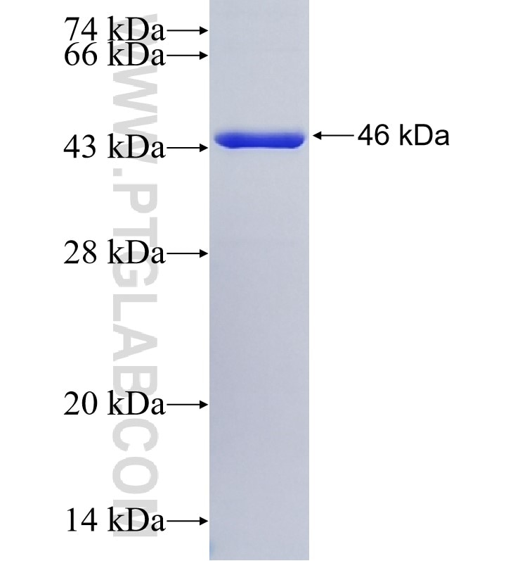 NPHP4 fusion protein Ag4882 SDS-PAGE