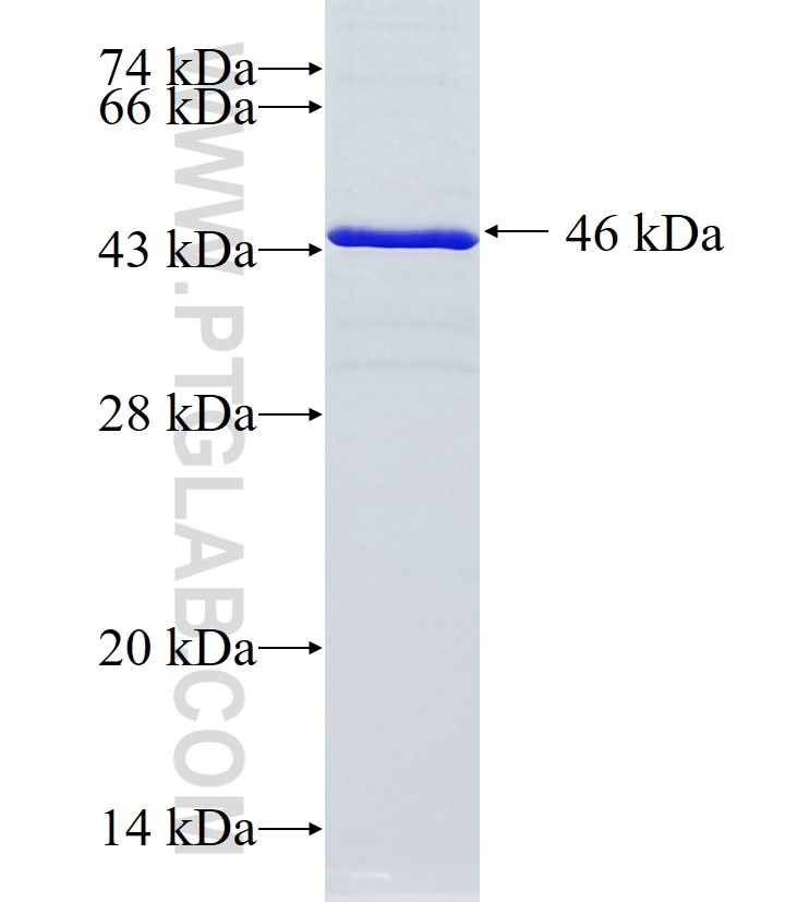 NPHP4 fusion protein Ag4882 SDS-PAGE