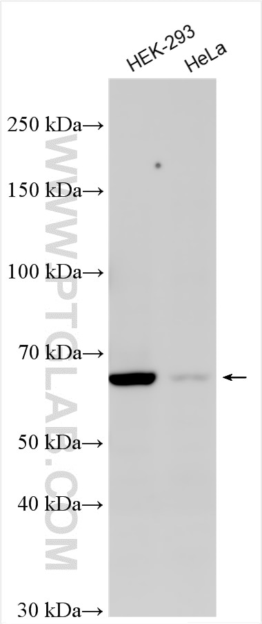 Western Blot (WB) analysis of various lysates using NPHP5/IQCB1 Polyclonal antibody (15747-1-AP)