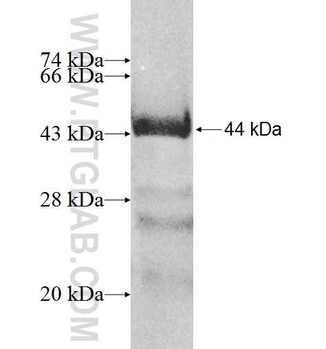 NPHP5,IQCB1 fusion protein Ag8203 SDS-PAGE