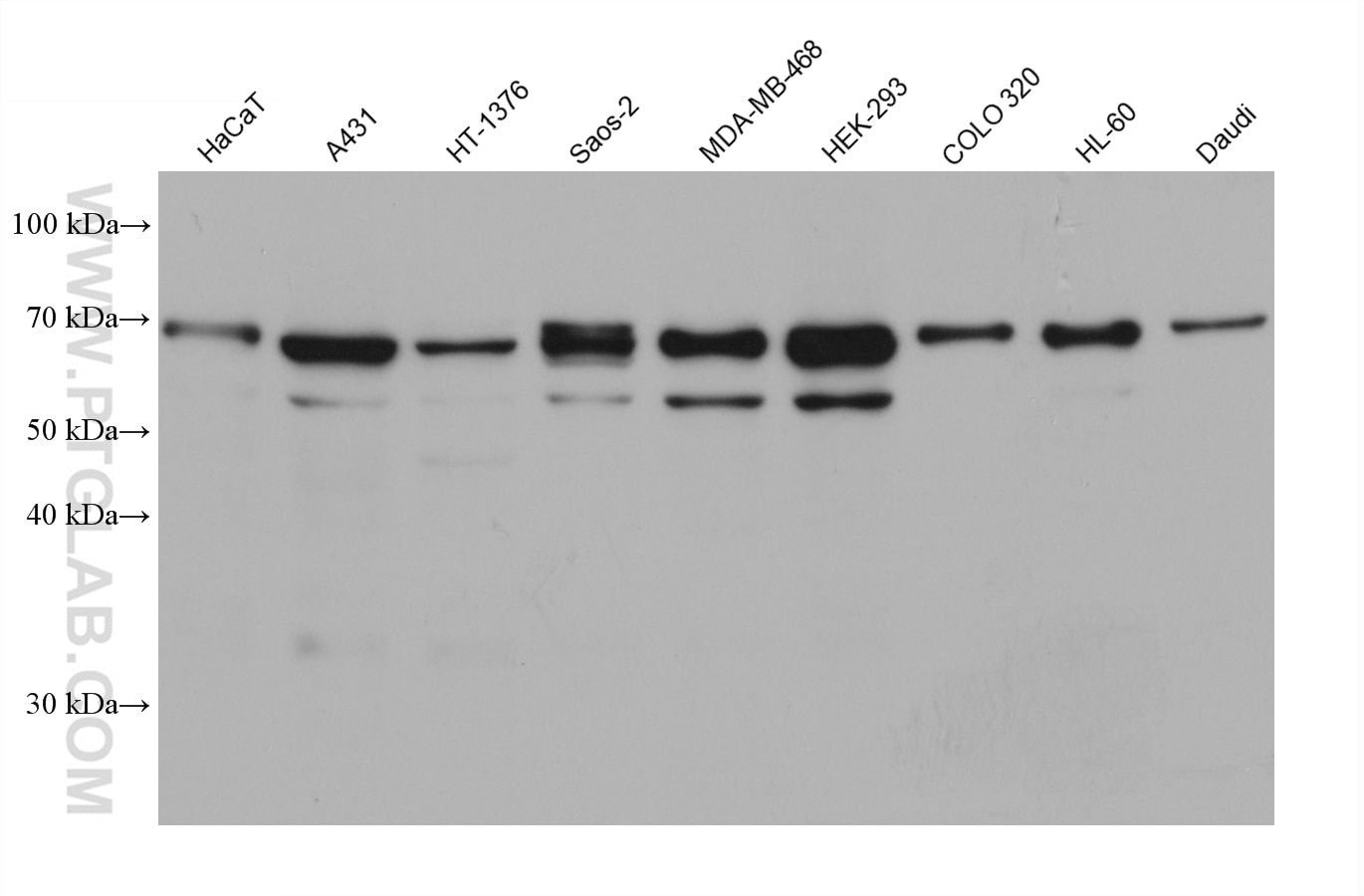 Western Blot (WB) analysis of various lysates using NPHP5,IQCB1 Monoclonal antibody (68404-1-Ig)