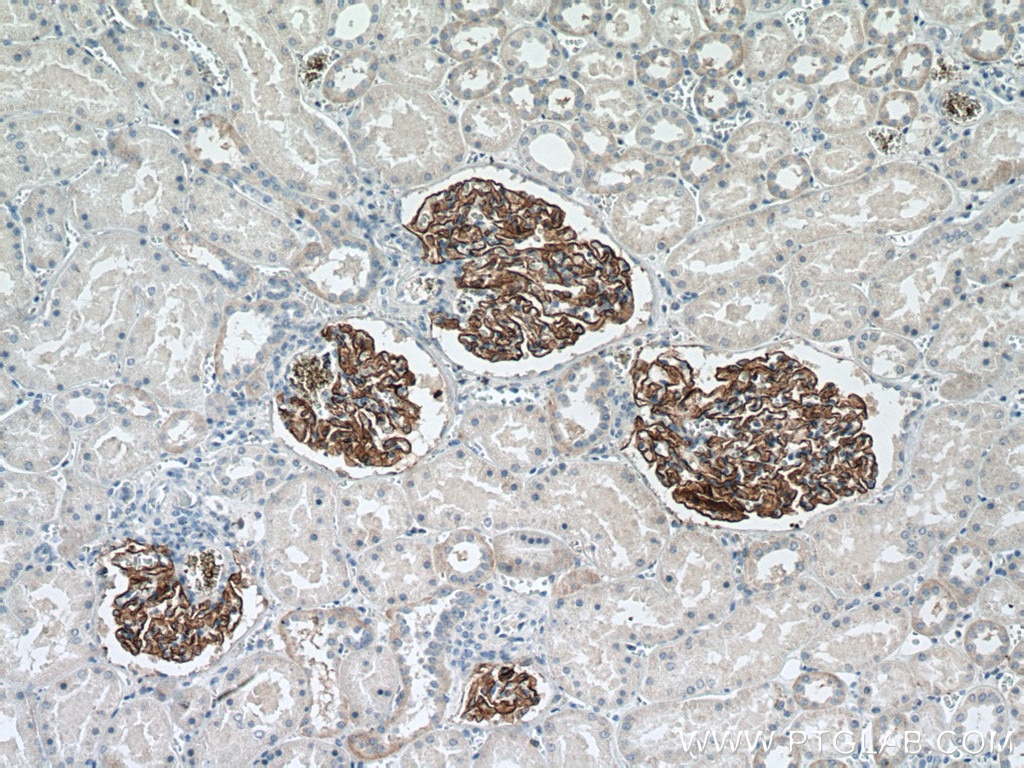 Immunohistochemistry (IHC) staining of human kidney tissue using Nephrin Monoclonal antibody (66970-1-Ig)
