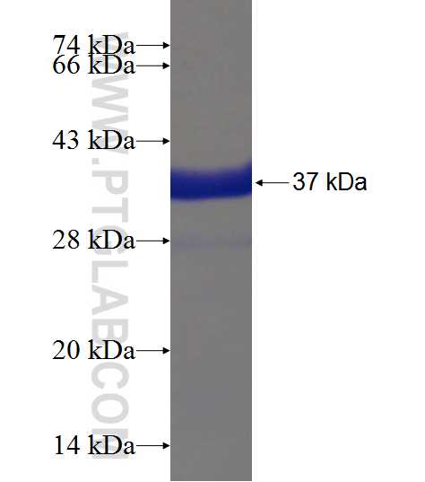 NPHS1 fusion protein Ag19273 SDS-PAGE