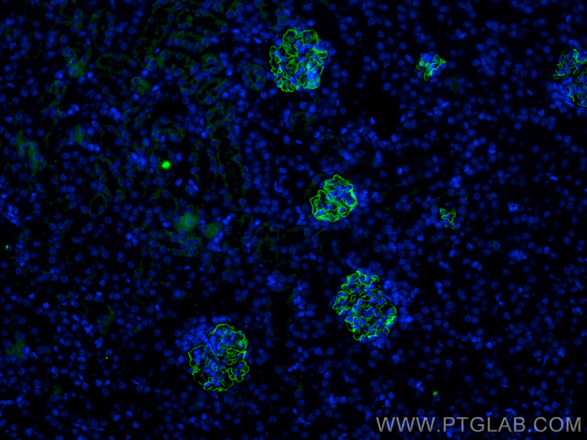 Immunofluorescence (IF) / fluorescent staining of mouse kidney tissue using NPHS2 Polyclonal antibody (20384-1-AP)