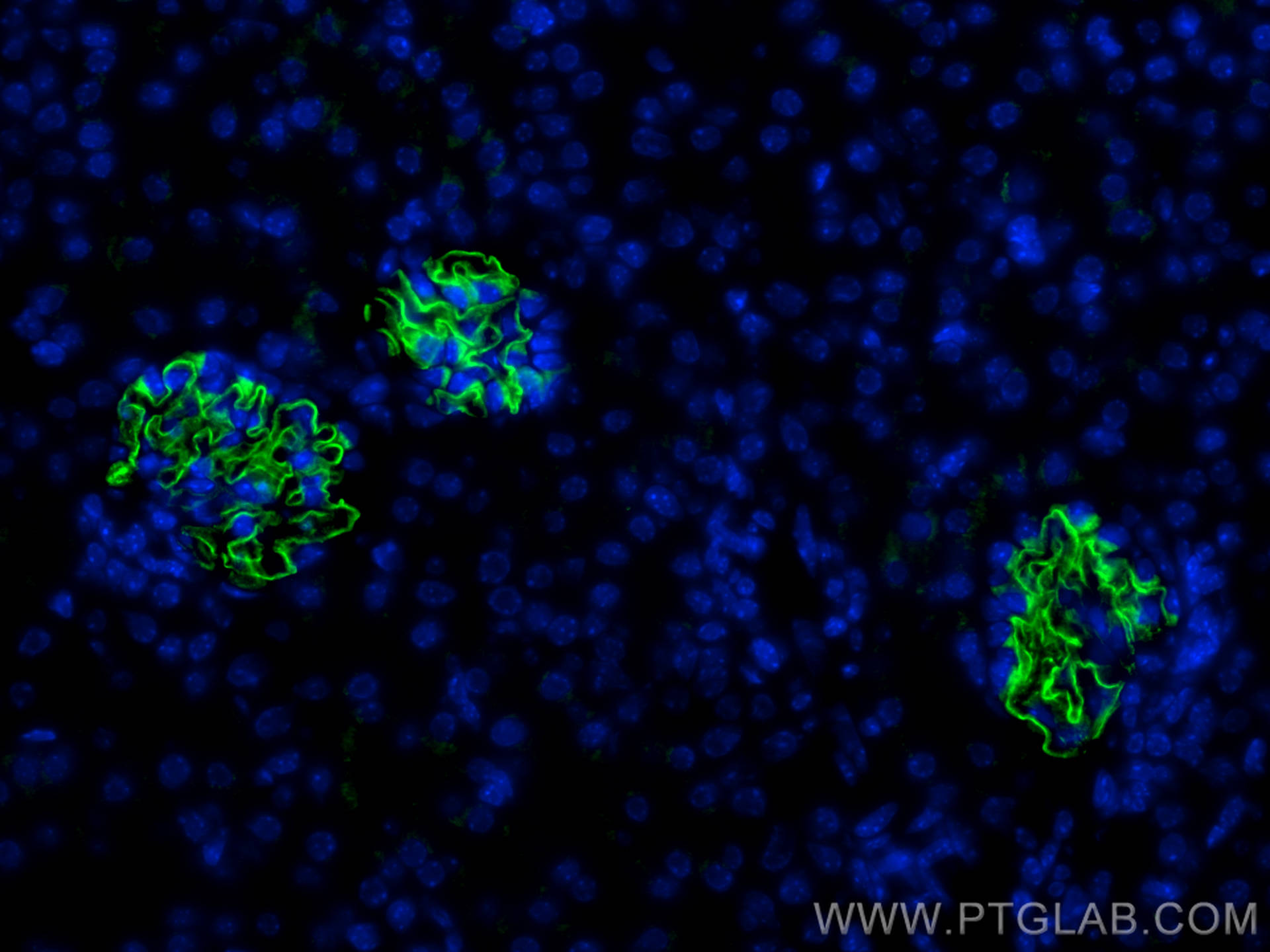 Immunofluorescence (IF) / fluorescent staining of mouse kidney tissue using NPHS2 Polyclonal antibody (20384-1-AP)