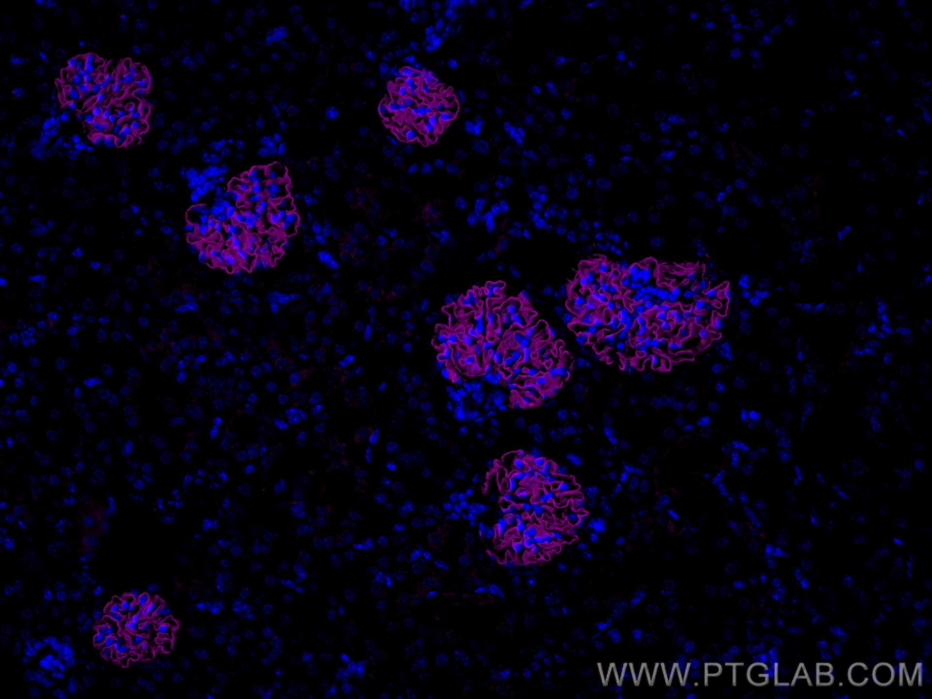 IF Staining of mouse kidney using 20384-1-AP