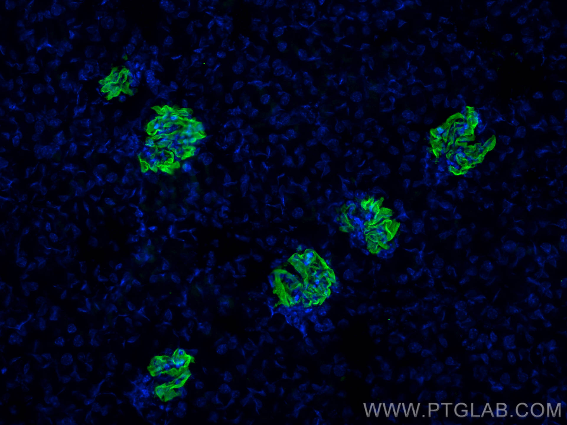 Immunofluorescence (IF) / fluorescent staining of mouse kidney tissue using NPHS2 Polyclonal antibody (20384-1-AP)