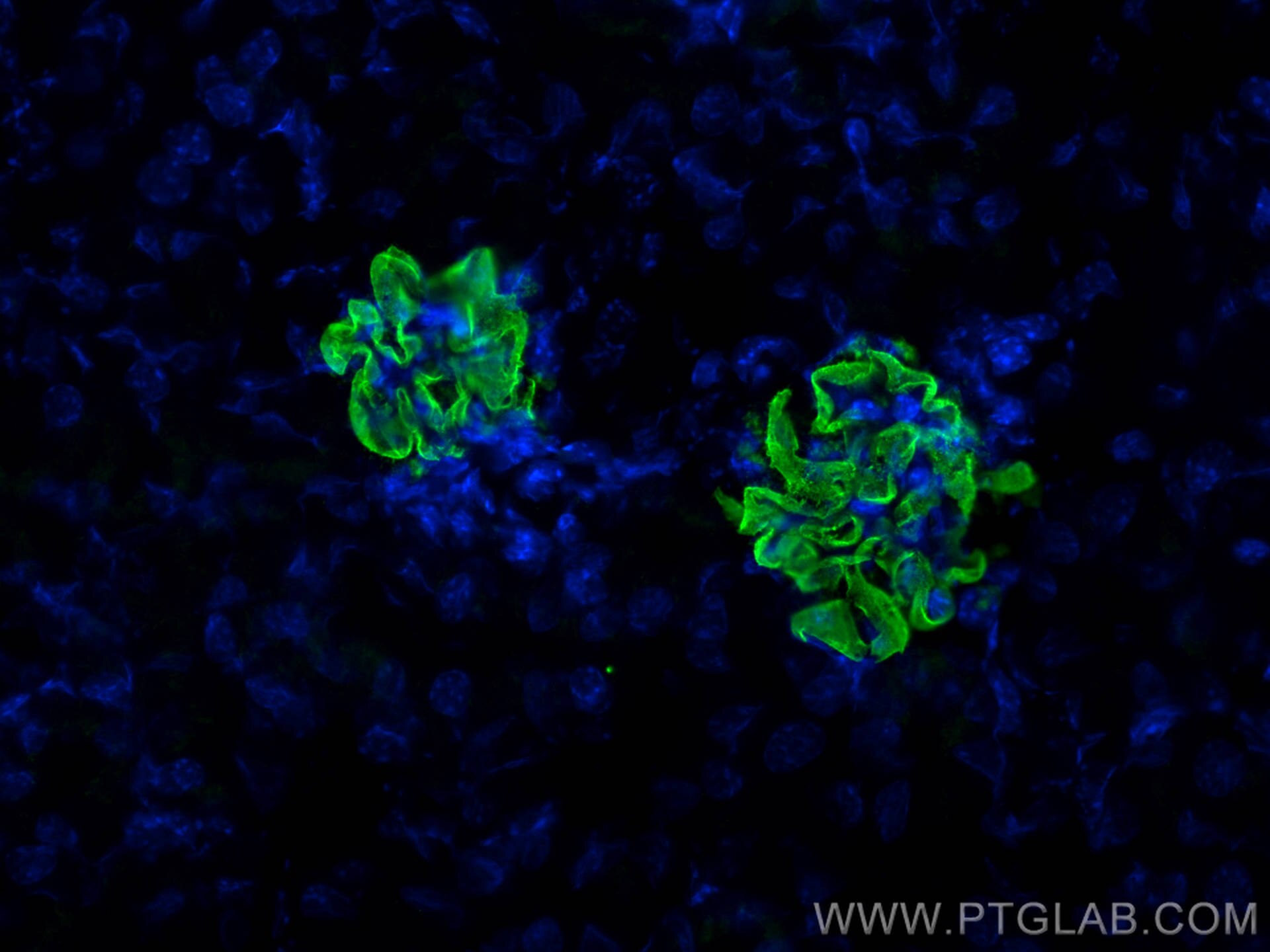 Immunofluorescence (IF) / fluorescent staining of mouse kidney tissue using NPHS2 Polyclonal antibody (20384-1-AP)