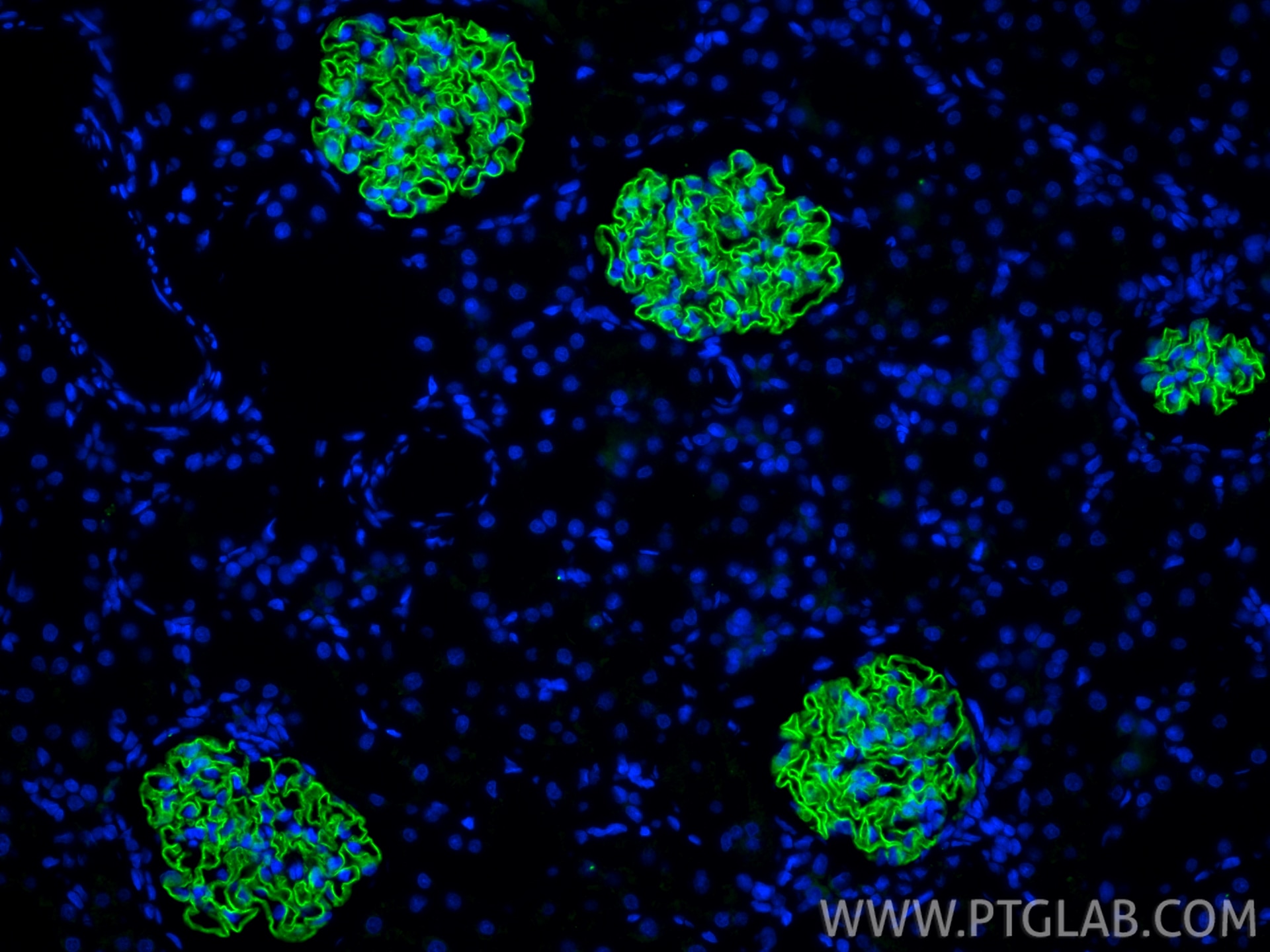 Immunofluorescent analysis of (4% PFA) fixed paraffin-embedded rat kidney tissue using NPHS2 antibody (20384-1-AP) at dilution of 1:1000 and CoraLite®488-Conjugated Goat Anti-Rabbit IgG(H+L) (SA00013-2). Heat mediated antigen retrieval with Tris-EDTA buffer (pH 9.0). Immunofluorescence (IF) / fluorescent staining of rat kidney tissue using NPHS2 Polyclonal antibody (20384-1-AP)