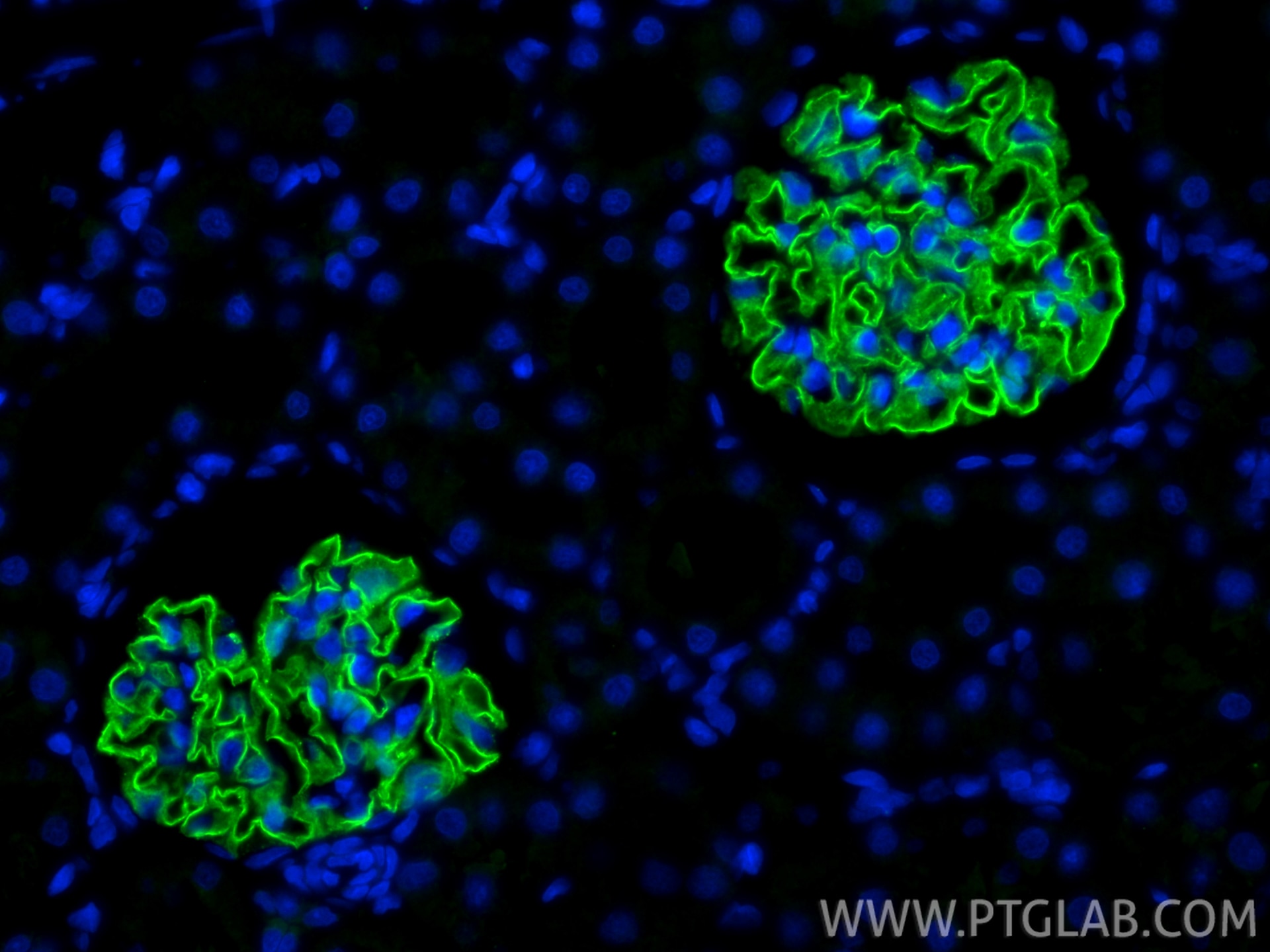 Immunofluorescent analysis of (4% PFA) fixed paraffin-embedded rat kidney tissue using NPHS2 antibody (20384-1-AP) at dilution of 1:1000 and CoraLite®488-Conjugated Goat Anti-Rabbit IgG(H+L) (SA00013-2). Heat mediated antigen retrieval with Tris-EDTA buffer (pH 9.0). Immunofluorescence (IF) / fluorescent staining of rat kidney tissue using NPHS2 Polyclonal antibody (20384-1-AP)