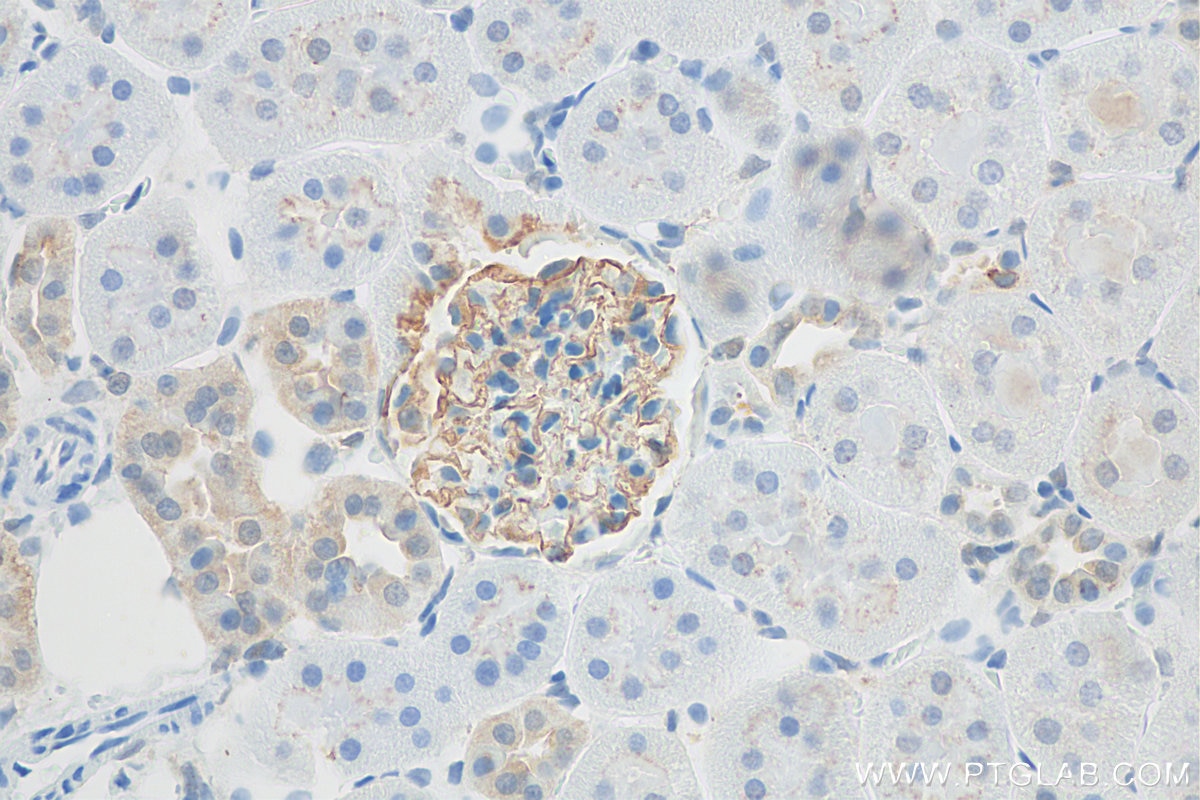 Immunohistochemistry (IHC) staining of rat kidney tissue using NPHS2 Polyclonal antibody (20384-1-AP)