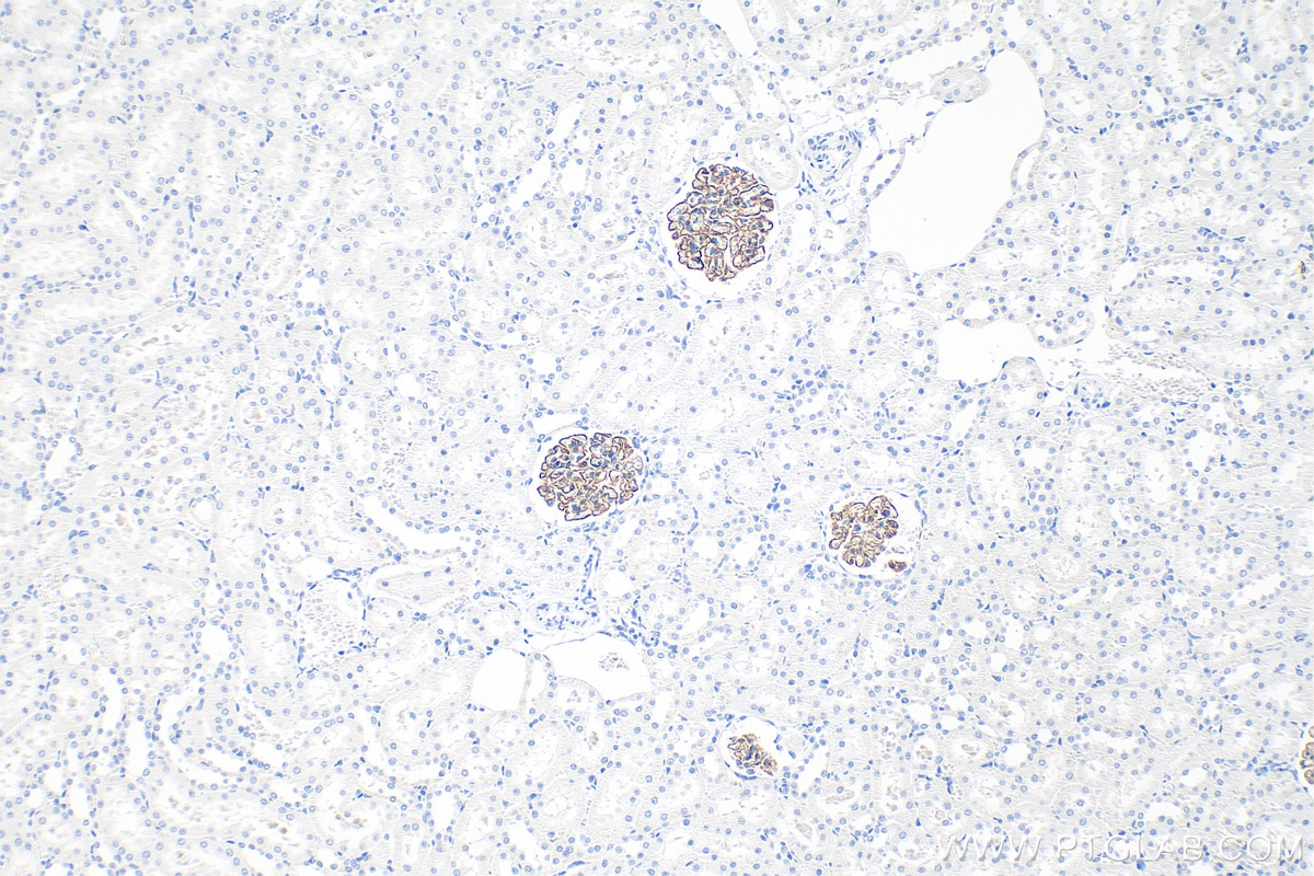 Immunohistochemical analysis of paraffin-embedded rat kidney tissue slide using 20384-1-AP (NPHS2 antibody) at dilution of 1:2000 (under 10x lens). Heat mediated antigen retrieval with Tris-EDTA buffer (pH 9.0). Immunohistochemistry (IHC) staining of rat kidney tissue using NPHS2 Polyclonal antibody (20384-1-AP)