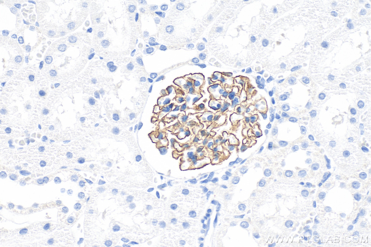 Immunohistochemical analysis of paraffin-embedded rat kidney tissue slide using 20384-1-AP (NPHS2 antibody) at dilution of 1:2000 (under 40x lens). Heat mediated antigen retrieval with Tris-EDTA buffer (pH 9.0). Immunohistochemistry (IHC) staining of rat kidney tissue using NPHS2 Polyclonal antibody (20384-1-AP)