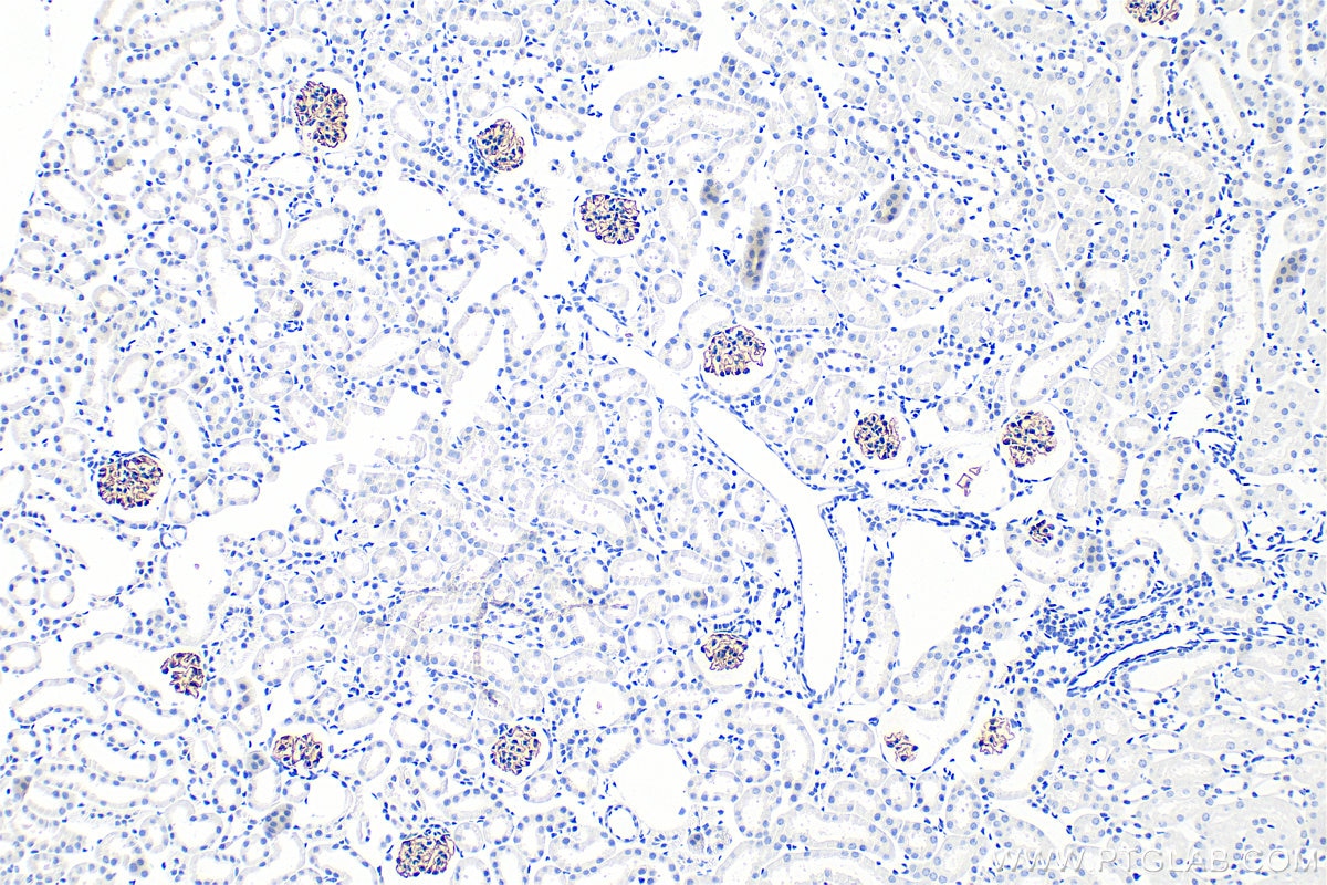 Immunohistochemistry (IHC) staining of mouse kidney tissue using NPHS2 Polyclonal antibody (20384-1-AP)