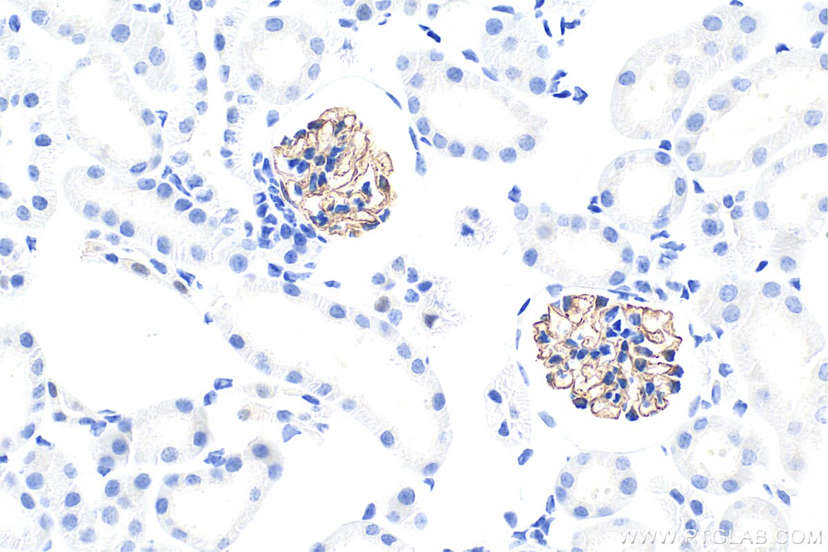 Immunohistochemistry (IHC) staining of mouse kidney tissue using NPHS2 Polyclonal antibody (20384-1-AP)