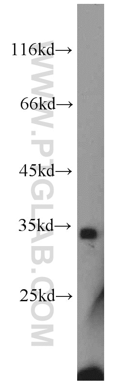 NPHS2 Polyclonal antibody