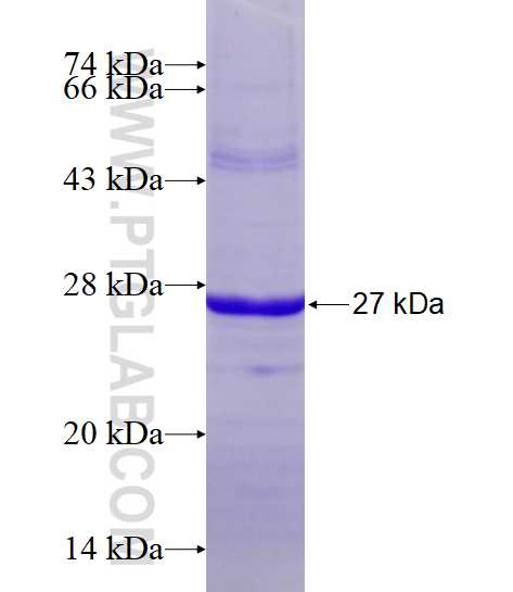 NPHS2 fusion protein Ag14671 SDS-PAGE