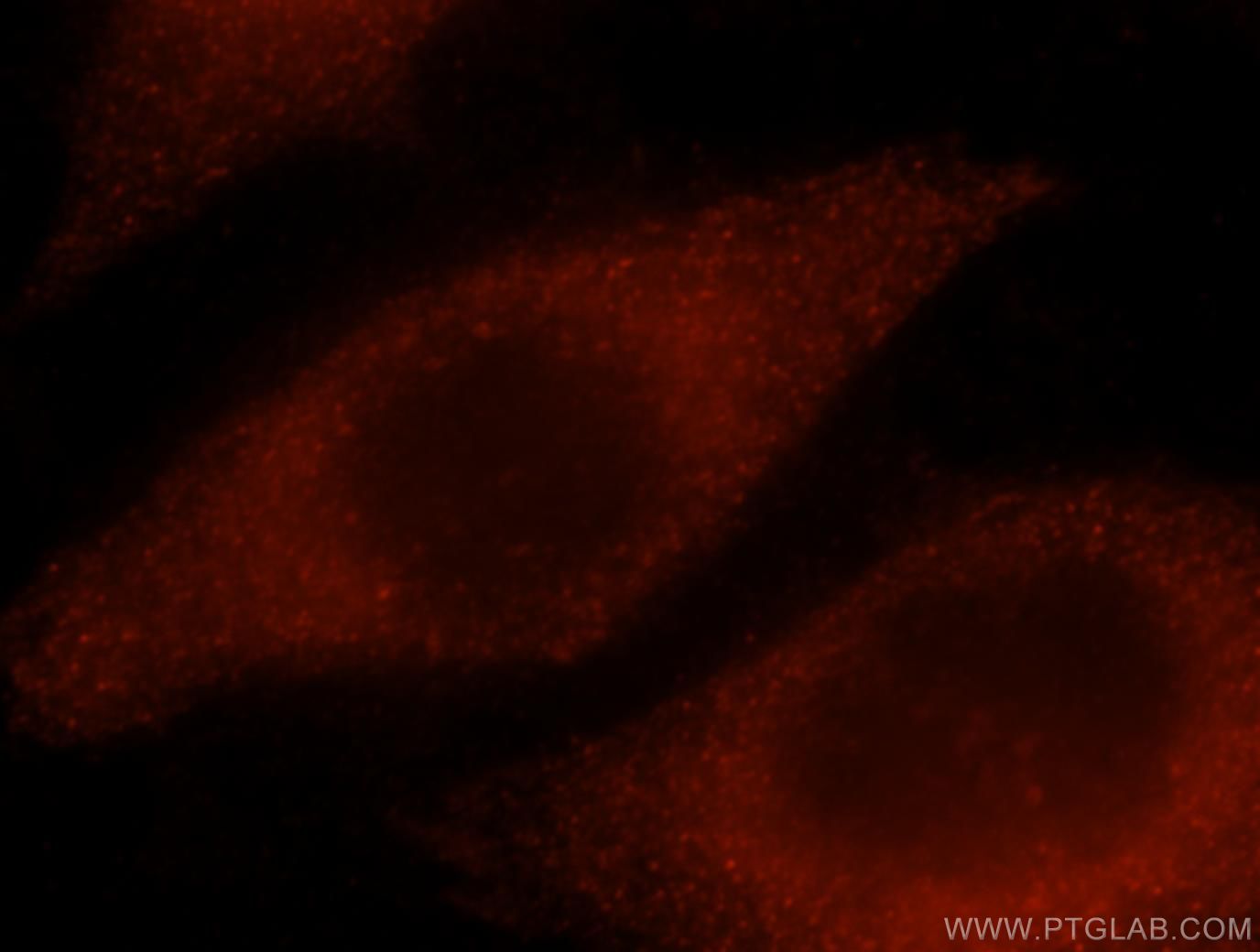 Immunofluorescence (IF) / fluorescent staining of MCF-7 cells using NPL Polyclonal antibody (16715-1-AP)