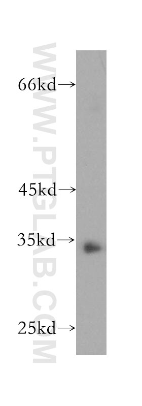 Western Blot (WB) analysis of Raji cells using NPL Polyclonal antibody (16715-1-AP)