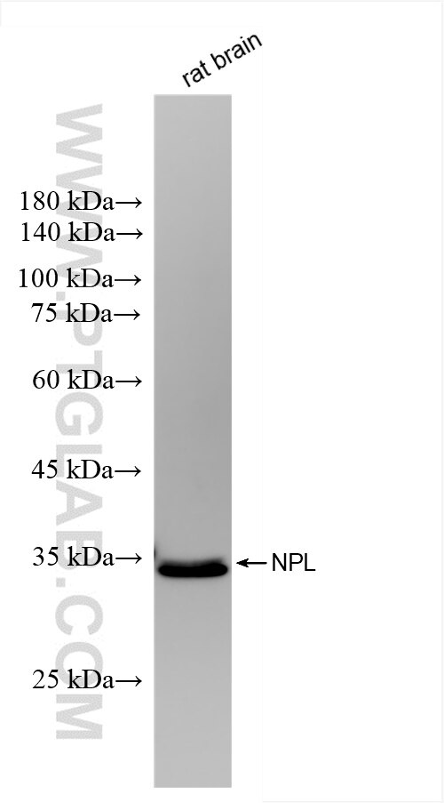 NPL