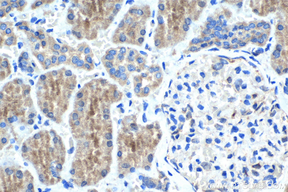 Immunohistochemical analysis of paraffin-embedded human kidney tissue slide using 11638-1-AP (NPLOC4 antibody) at dilution of 1:1000 (under 40x lens). Heat mediated antigen retrieval with Tris-EDTA buffer (pH 9.0). Immunohistochemistry (IHC) staining of human kidney tissue using NPLOC4 Polyclonal antibody (11638-1-AP)