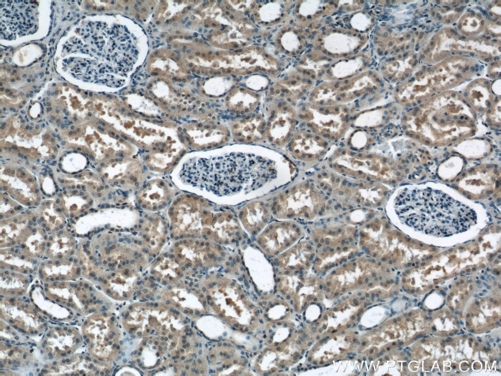 Immunohistochemistry (IHC) staining of human kidney tissue using NPLOC4 Polyclonal antibody (11638-1-AP)